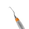 Curette Gracey Mini Five 11/12 - Everedge 2.0